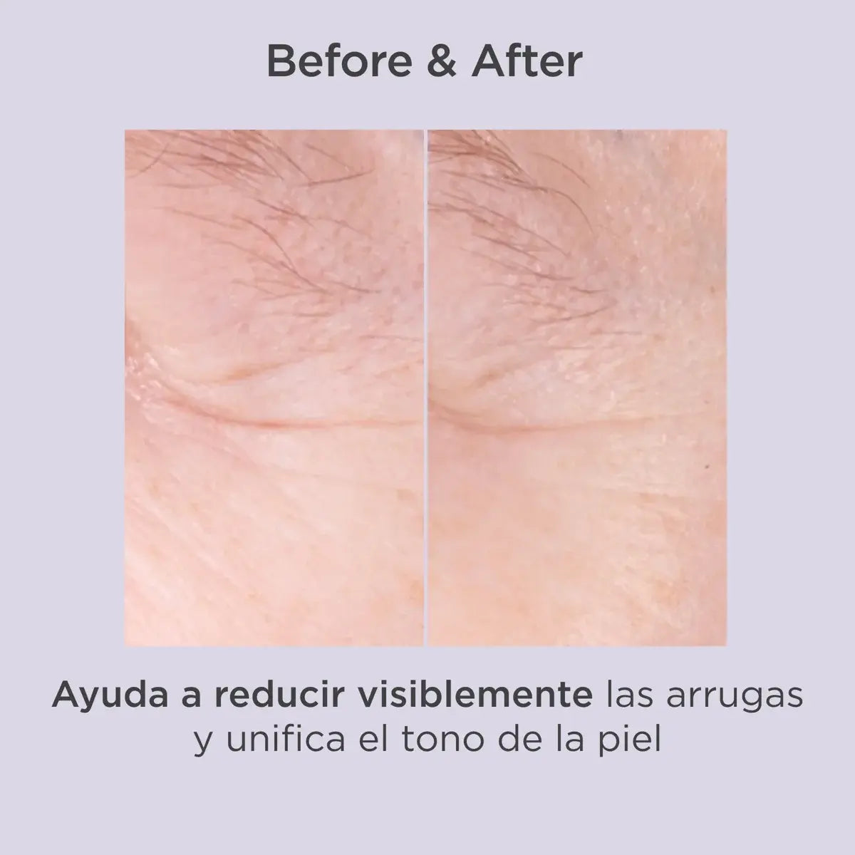 Glicoisdin® 15 Moderate