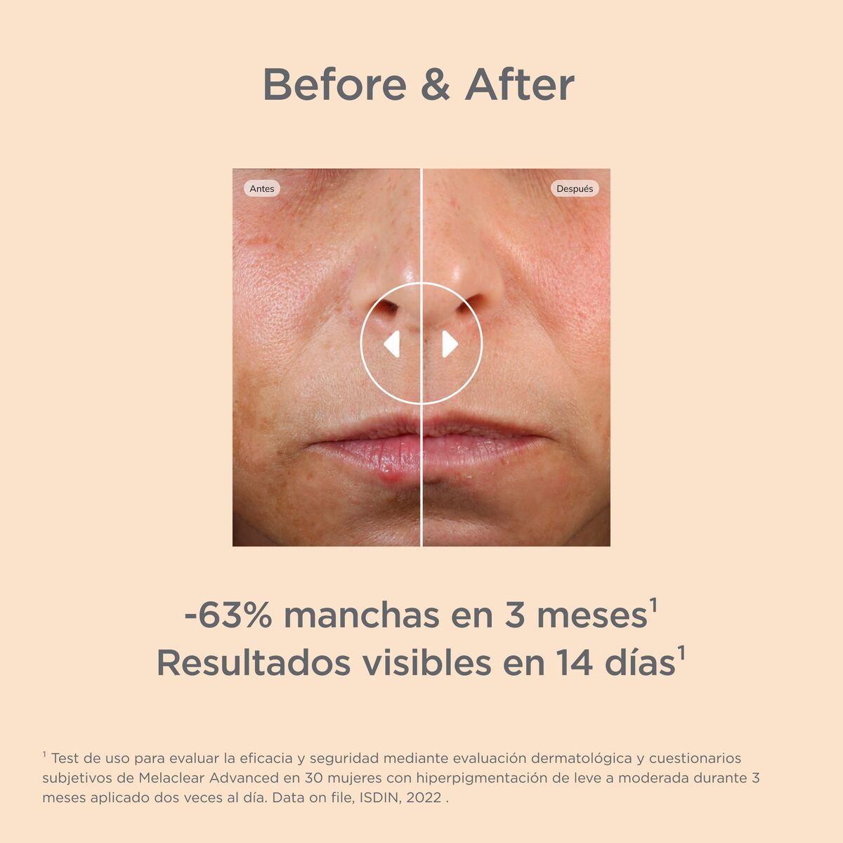 Melaclear Advanced 30ml